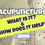 What Exactly is Acupuncture and How Does Acupuncture Work?