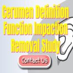 What Happens When Cerumen (Ear Wax) is Impacted?