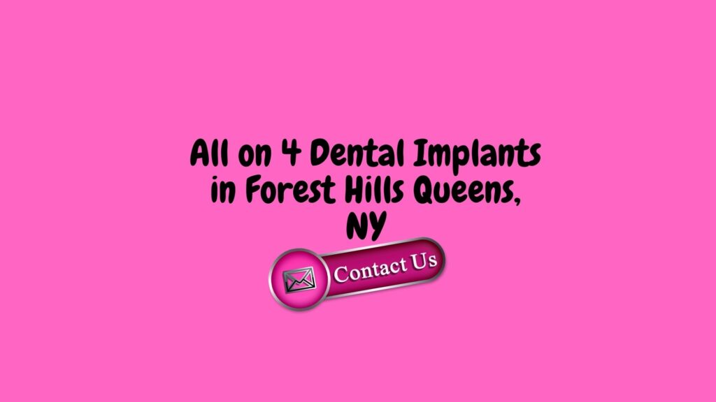 All on 4 Dental Implants in Forest Hills Queens, NY