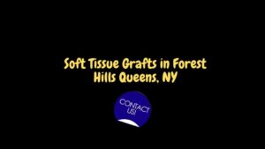 Know More About The Soft Tissue Grafts in Forest Hills Queens, NY