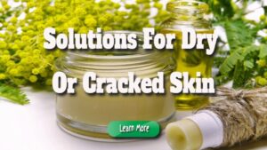Natural Skin Care Solutions for Dry or Cracked Skin